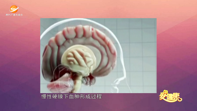 广告1